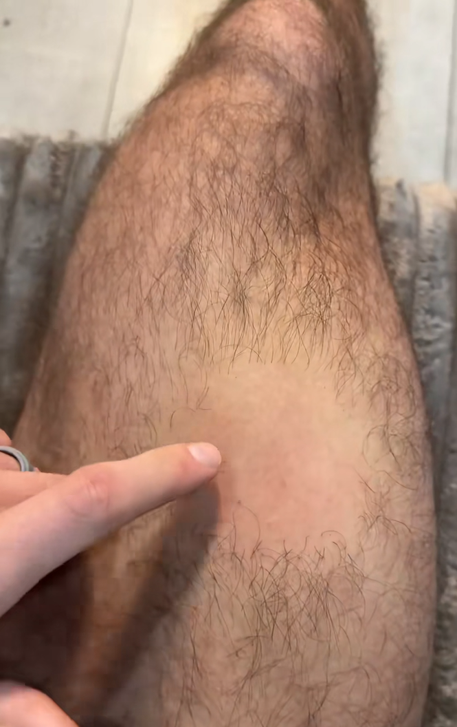 1. Smooth skin without the razor burn